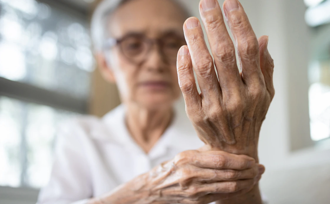 arthritis for blog post
